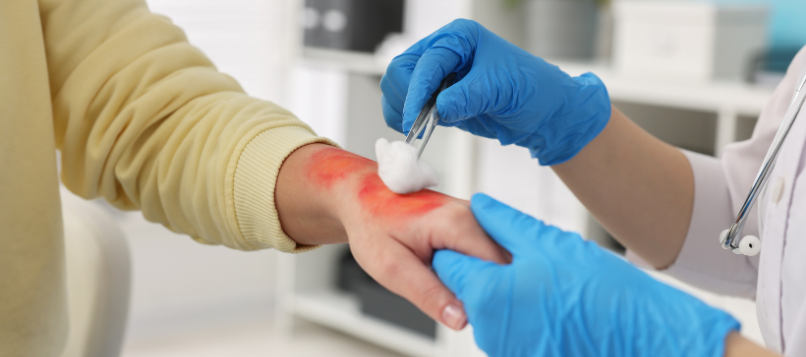 Best Plastic & Burn Surgery Hospital in Raipur